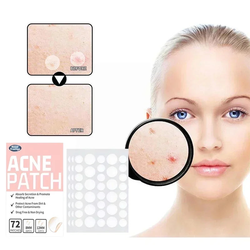 Invisible Acne Patches 72-180 Pcs